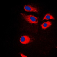 Anti-RPS9 Antibody