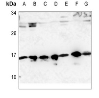 RPS19 Antibody