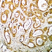 Anti-RPS19 Antibody