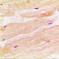 Anti-RRAD Antibody