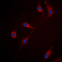 Anti-RRAD Antibody