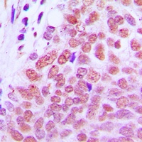 Anti-RXR gamma Antibody