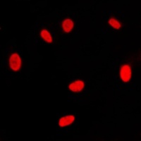 Anti-RXR gamma Antibody