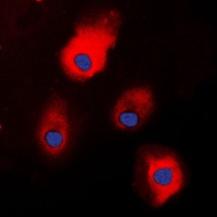 S100A1 antibody