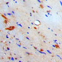 Anti-S100-A10 Antibody