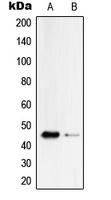 Serpin B4 Rabbit Polyclonal Antibody