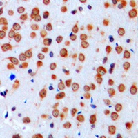 SCN1A antibody