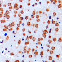 Anti-Nav1.1 Antibody