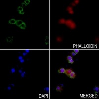 Anti-CXCL12 Antibody