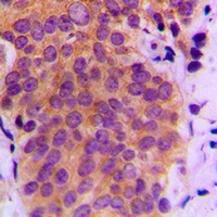 Anti-MKK4 (Phospho-S80) Antibody