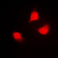 Anti-MKK4 (Phospho-T261) Antibody