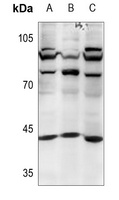 MKK4 Rabbit Polyclonal Antibody
