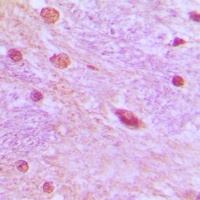 SRSF3 Antibody