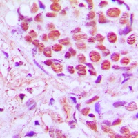 Anti-SRSF4 Antibody