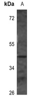 Surfactant Protein B Antibody