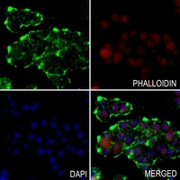 SFTPB antibody