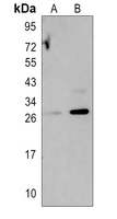 Beta-sarcoglycan Rabbit Polyclonal Antibody