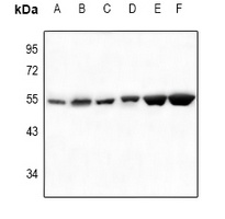 SGK1/2 Antibody