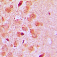 Anti-CD75 Antibody