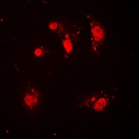 SKP2 antibody