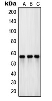 EAAT3 Rabbit Polyclonal Antibody