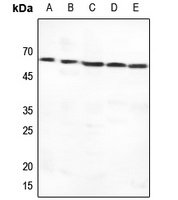 GLUT1 Rabbit Polyclonal Antibody