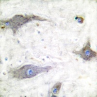 Anti-GLUT1 Antibody
