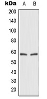 GLUT2 Rabbit Polyclonal Antibody