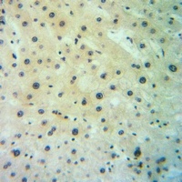 Anti-SGLT2 Antibody