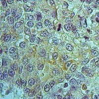 Anti-PEPT1 Antibody