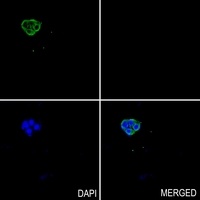 Anti-PEPT1 Antibody