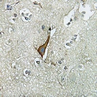 Anti-OATP1 Antibody