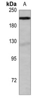 BRM Rabbit Polyclonal Antibody