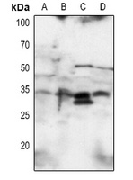 SNAI1 Rabbit Polyclonal Antibody