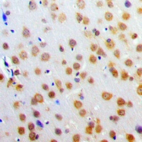 Anti-SNAP25 Antibody