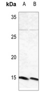 Beta-synuclein Rabbit Polyclonal Antibody