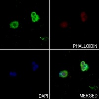 Anti-SNX1 Antibody