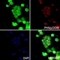 SOD1 antibody