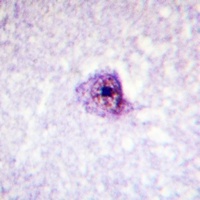 Anti-SOX9 (Phospho-S181) Antibody