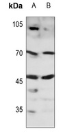SOX11 Antibody