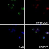 Anti-SOX11 Antibody