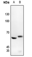 c-SRC (Phospho-Y529) Antibody