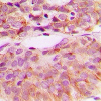c-SRC (Phospho-Y529) Antibody