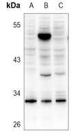 SRD5A1 Antibody