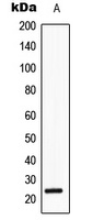 SRY Antibody