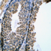 Anti-SRY Antibody