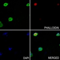 Anti-TROVE2 Antibody