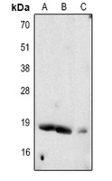 Somatostatin Rabbit Polyclonal Antibody