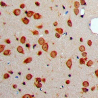 Somatostatin Rabbit Polyclonal Antibody