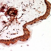 Anti-SSX-pan Antibody